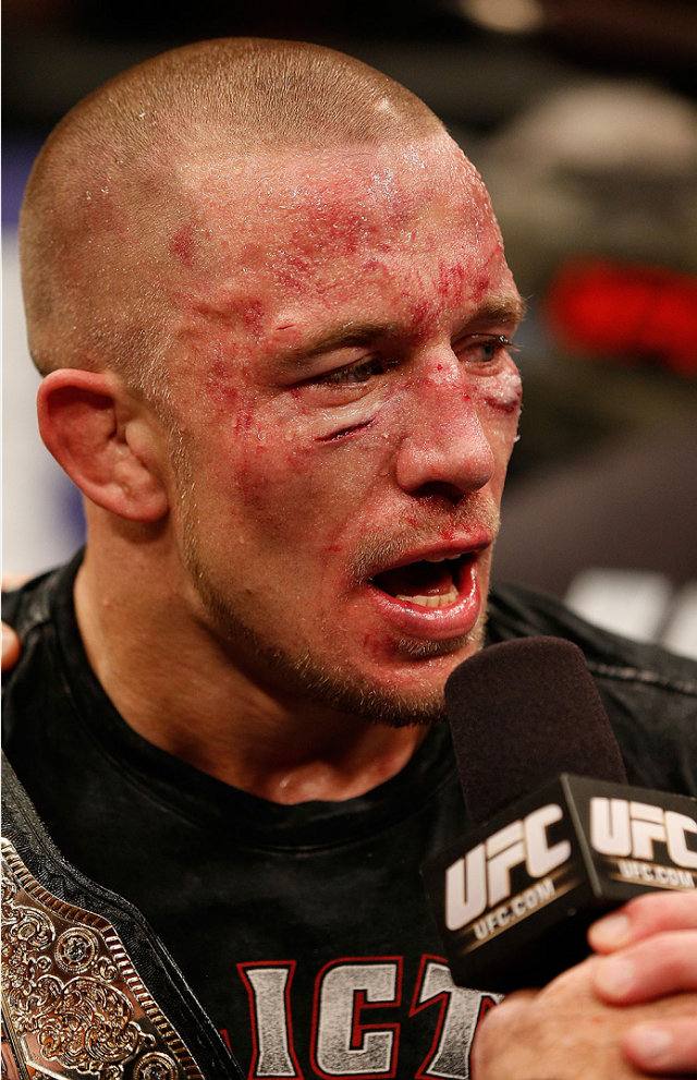 Чемпион UFC Джордж Сен-Пьер (Photo by Josh Hedges/Zuffa LLC/Zuffa LLC via Getty Images)