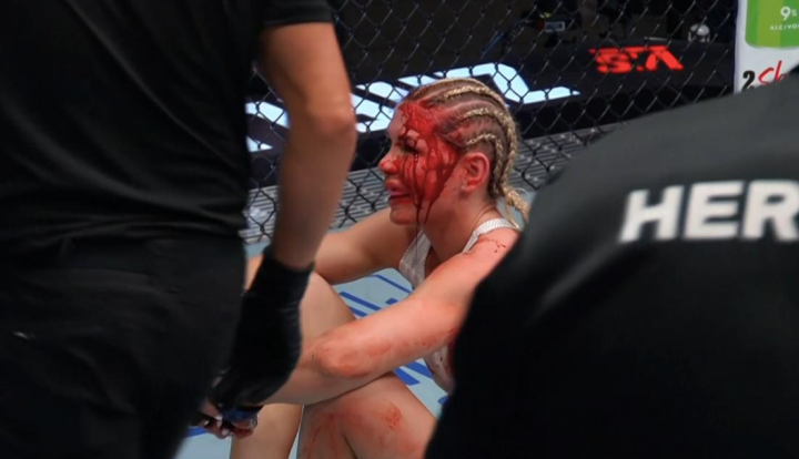 Россиянка Железнякова получила жесткое рассечение на турнире UFC Fight Night 290